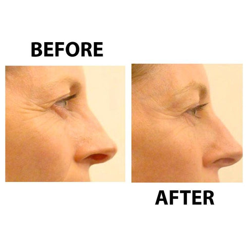 Collagen Boosting Skin Treatment | Biologically Active Collagen Anti-Aging Serum Collagen Boosting Skin Treatment | Biologically Active Collagen Anti-Aging Serum