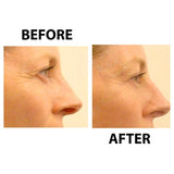 Collagen Boosting Skin Treatment | Biologically Active Collagen Anti-Aging Serum Collagen Boosting Skin Treatment | Biologically Active Collagen Anti-Aging Serum