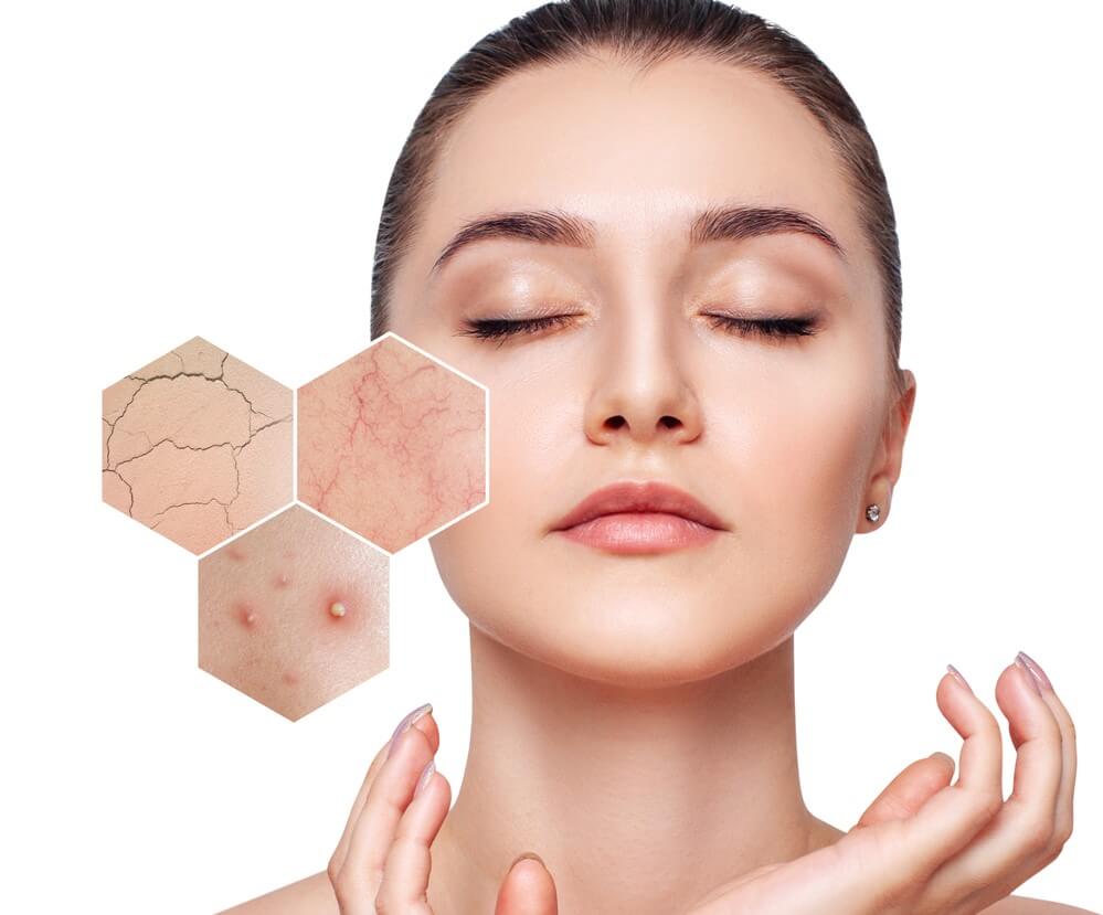 Sensitive Skin